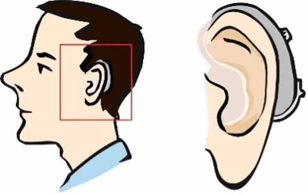 Mann mit Hör-Gerät.